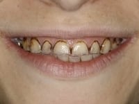 Konig Center for Cosmetic & Comprehensive Dentistry smile photos